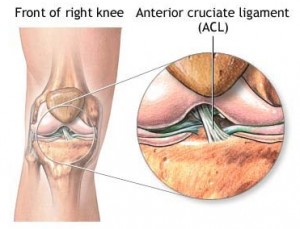 Ligament incrucisat anterior