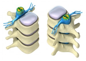 Human spine in details: Vertebra, bone marrow, disc and nerves